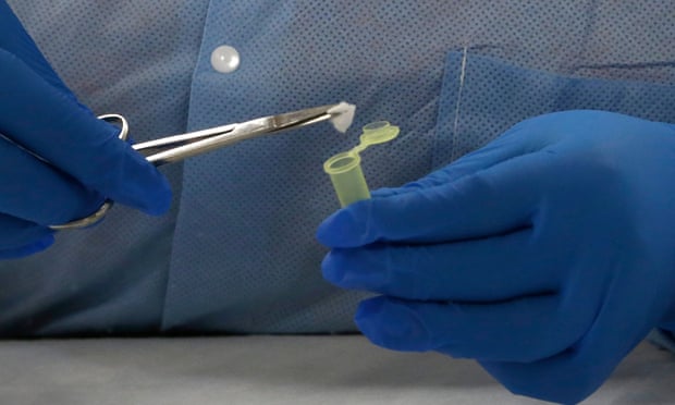 ‘Super-smeller’ helps develop swab test for Parkinson’s disease