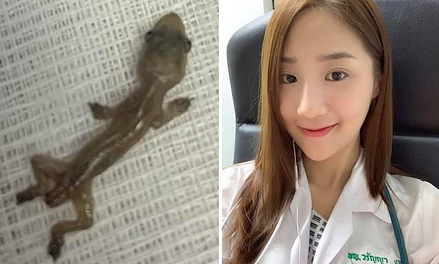 Patient discovers a gecko in her ear after going to the doctor complaining of ear pain | Daily Mail Online
