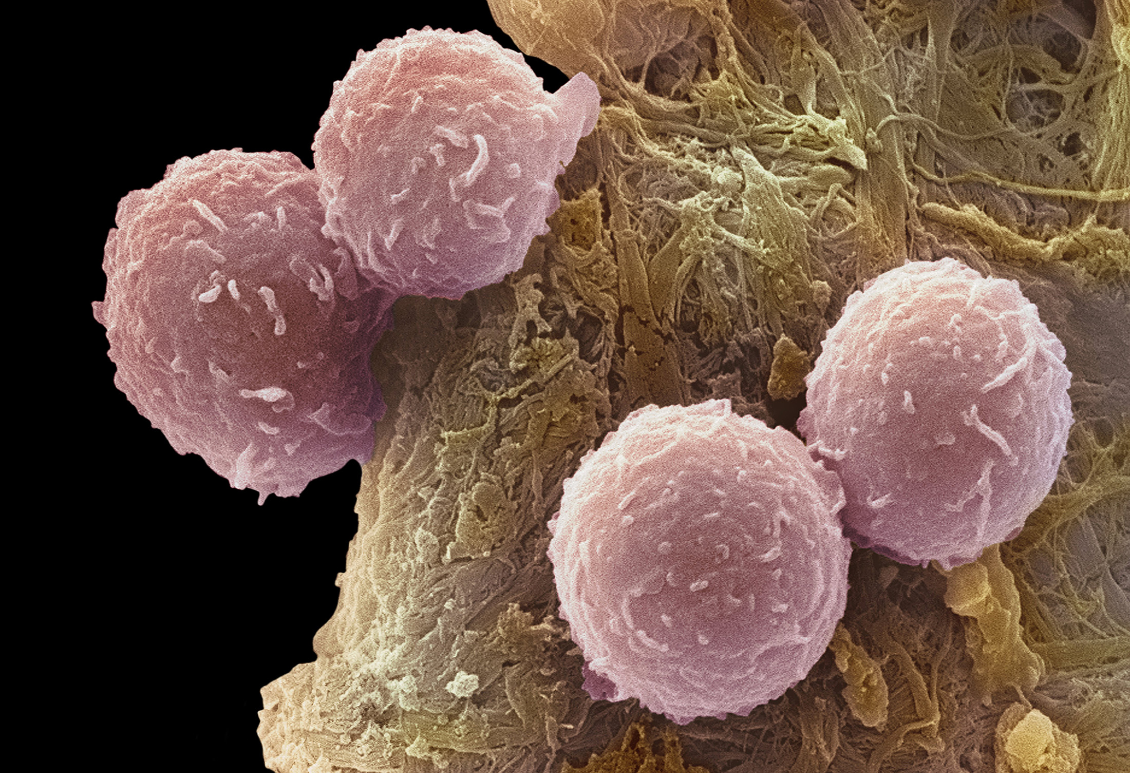 Drug to replace chemotherapy may reshape cancer care