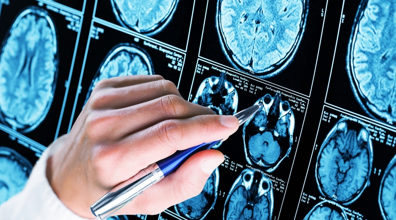 Researchers Develop Vaccine That Could Possibly Prevent Alzheimer’s